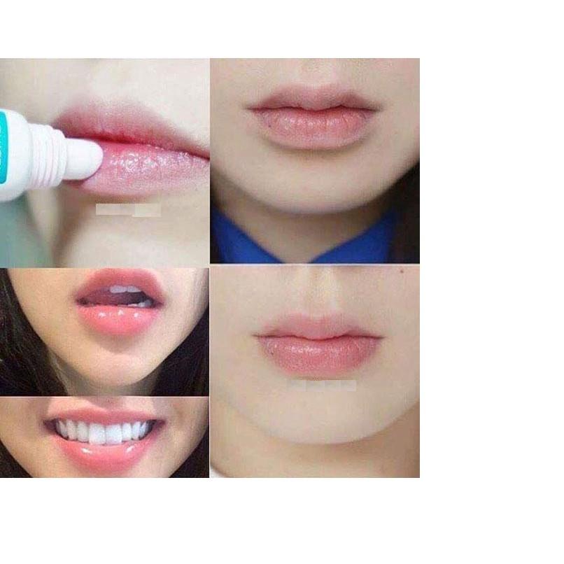 Son Dưỡng chuyên dùng cho môi khô nứt nẻ, thâm, bợt màu, nhợt nhạt Mediheal Labocare Panteno Lips 10ml