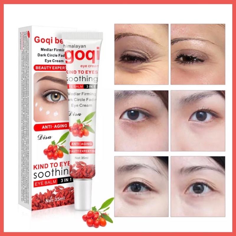 VOPRO Goqi Berry Kem Dưỡng Ẩm Làm Trắng Mắt Khói, Chăm Sóc Mắt 35Ml