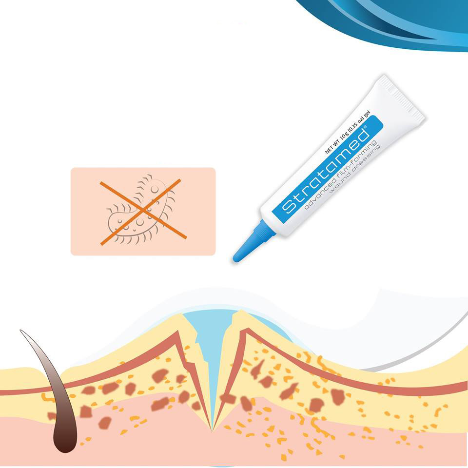 Gel silicone STRATAMED Thụy Sỹ hỗ trợ phục hồi và cải thiện vết thương hở, sẹo bỏng - Hàng chính hãng