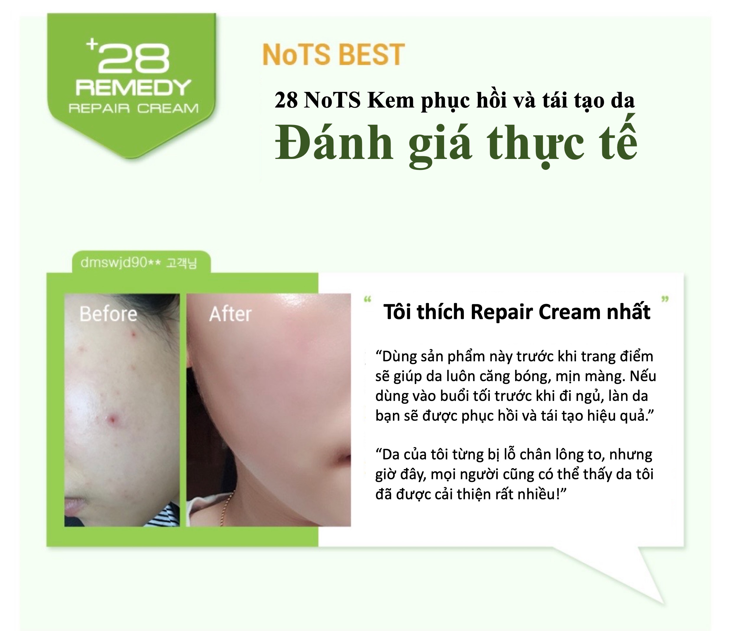 KEM DƯỠNG DA NOTS 28 REMEDY REPAIR CREAM