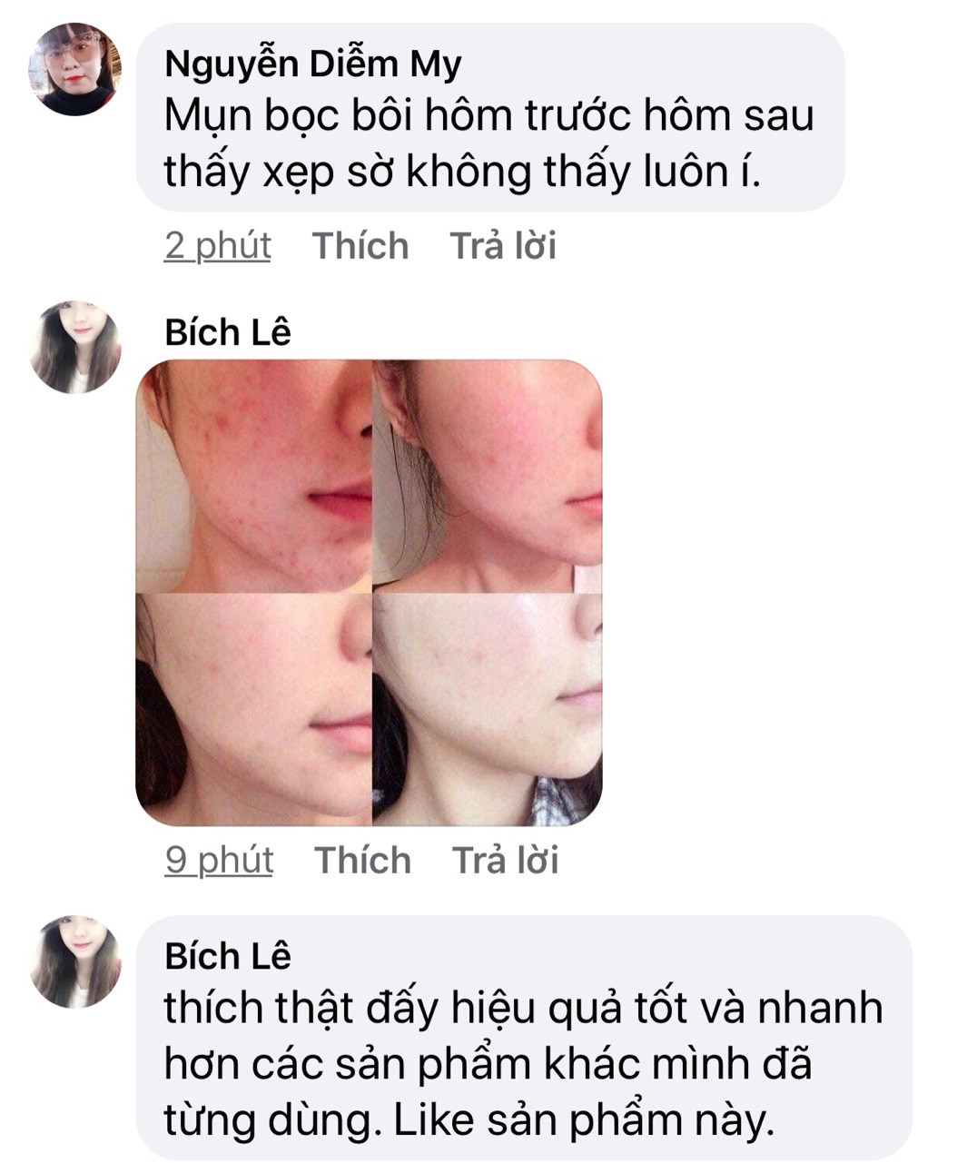 SERUM HỖ TRỢ TRỊ MỤN NHANH 99,9%. NGĂN NGỪA TÁI PHÁT,ANTI ACNES PRO MYLOKY