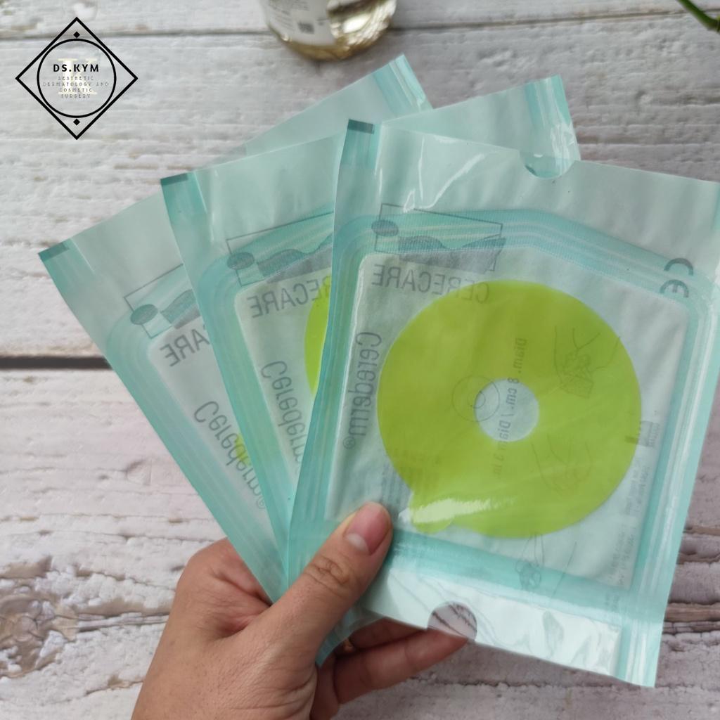 Dán sẹo tròn quầng Cerederm Circle