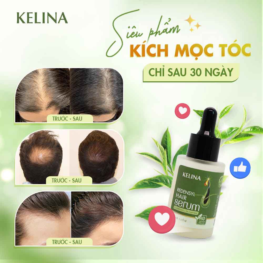 Tinh Chất Redensyl Hair Serum Cao Cấp Kích Thích Mọc Tóc, Ngăn Ngừa Rụng Tóc, Hỗ Trợ Làm Dày Và Chắc Khỏe Tóc Kelina 30ml