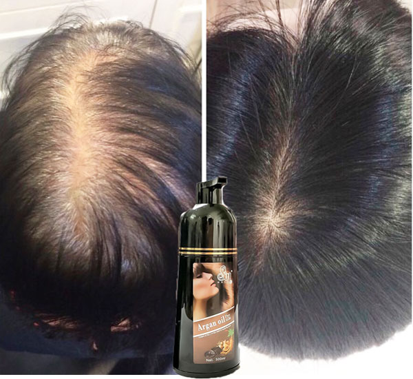 Hình ảnh [CHÍNH HÃNG] Dầu Gội Phủ Bạc Nhân Sâm Sin Hair, Phủ Bạc Đen Tóc, Nâu Tóc Từ Lần Gội Đầu Tiên, 100% Thảo Dược Thiên Nhiên