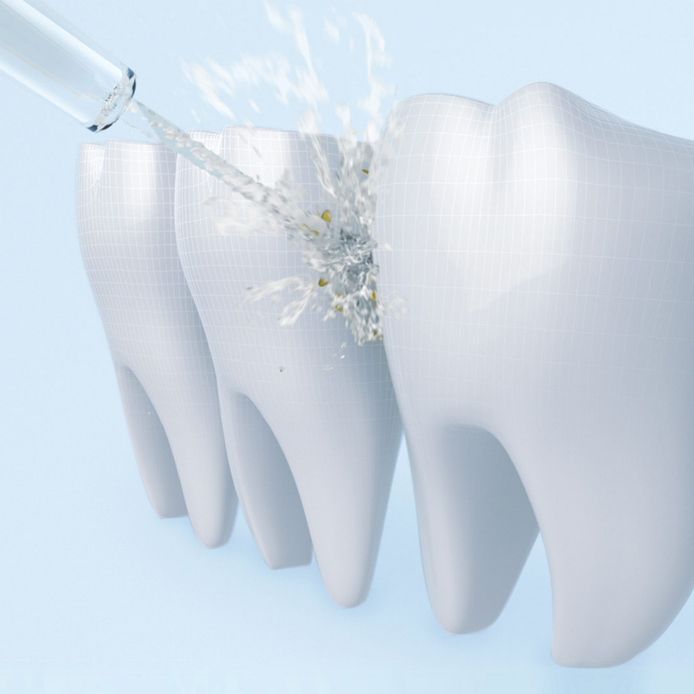 Máy tăm nước Xiaomi Mijia Flosser - Bình xịt vệ sinh răng miệng Xiaomi Mijia Flosser
