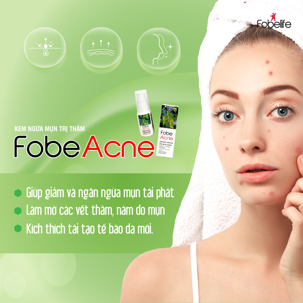 Combo 2 Chai Kem Làm Mờ Thâm Mụn Sẹo Mụn FOBE Acne - Chai 15 gram