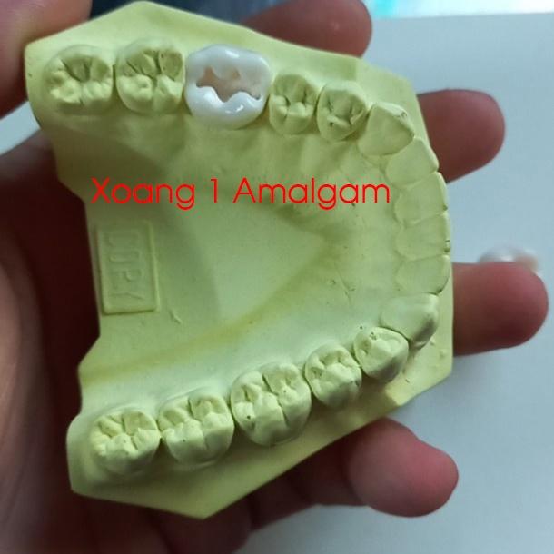 Răng nhựa nha khoa cho sinh viên thực hành (hàng có sẵn)