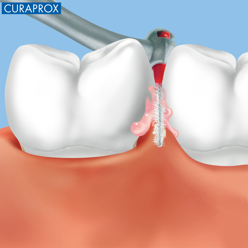 Bộ 4 bàn chải kẽ răng CURAPROX CPS chairside