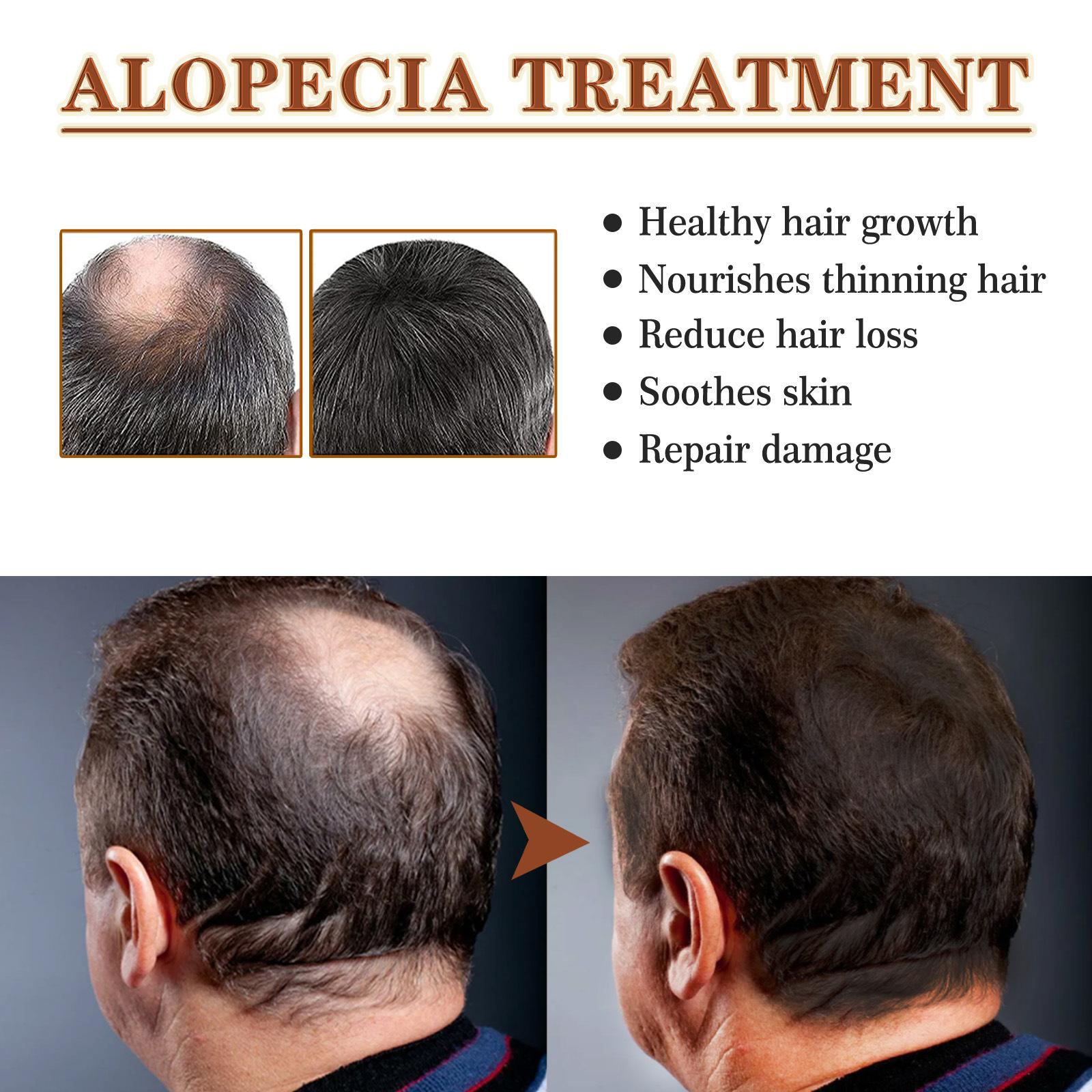 EELHOE 50ml Hair Growth Oil Nourishing Hair Anti-Breakage Repair Dry Frizzy Hair Growth Treatment Oil