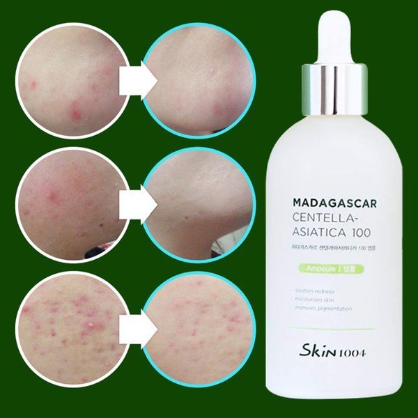 Tinh Chất Rau Má Giảm Mụn, Phục Hồi Da Skin1004 Madagascar Centella Asiatica 100 Ampoule 50ml