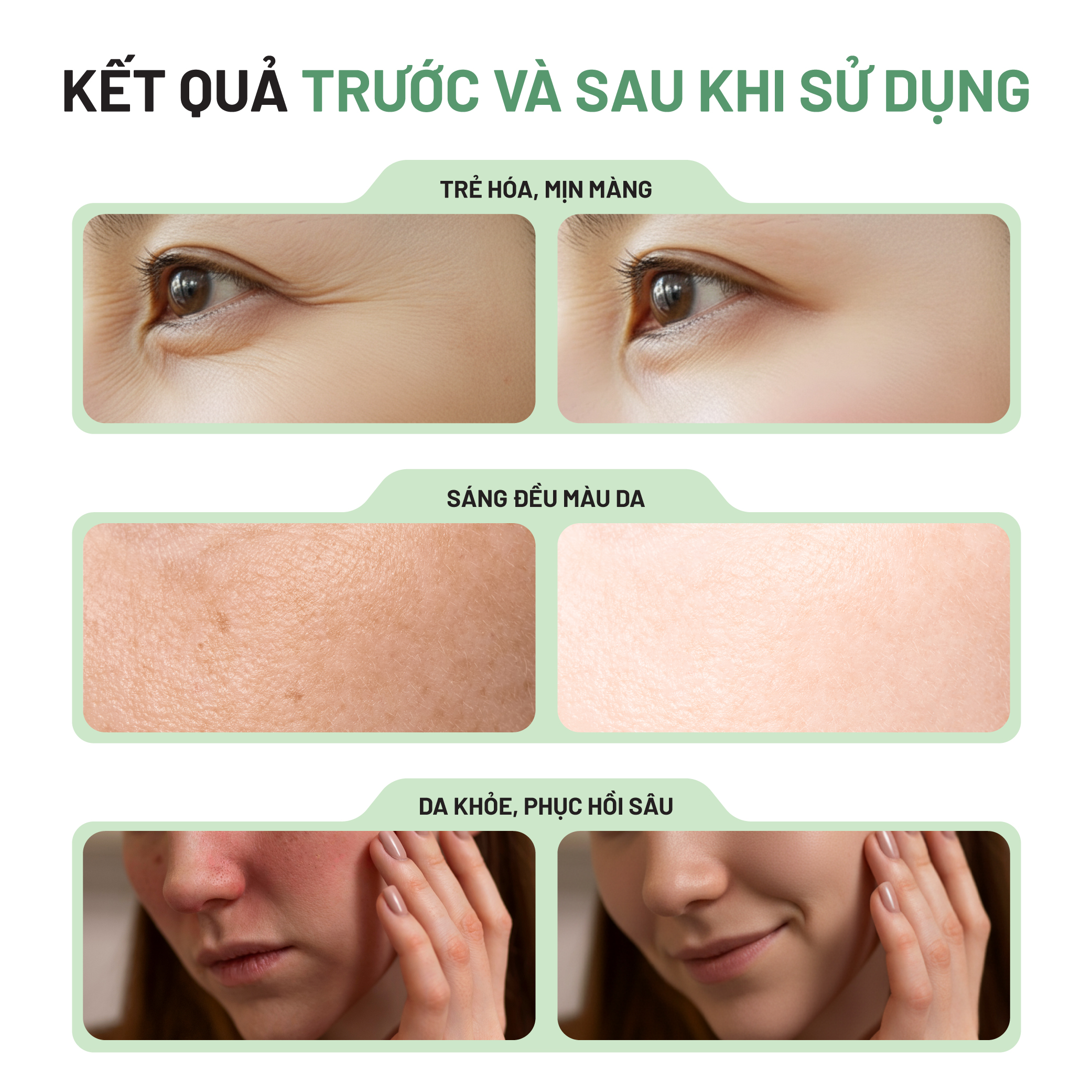 Tinh Chất Serum Thuần Chay Nha Đam Xương Rồng Heebee’s Aloe Vera Cactus Brightening Serum Dưỡng Trắng, Cấp Ẩm, Trị Mụn, Se Khít Lỗ Chân Lông, Ngừa Lão Hóa 38ml
