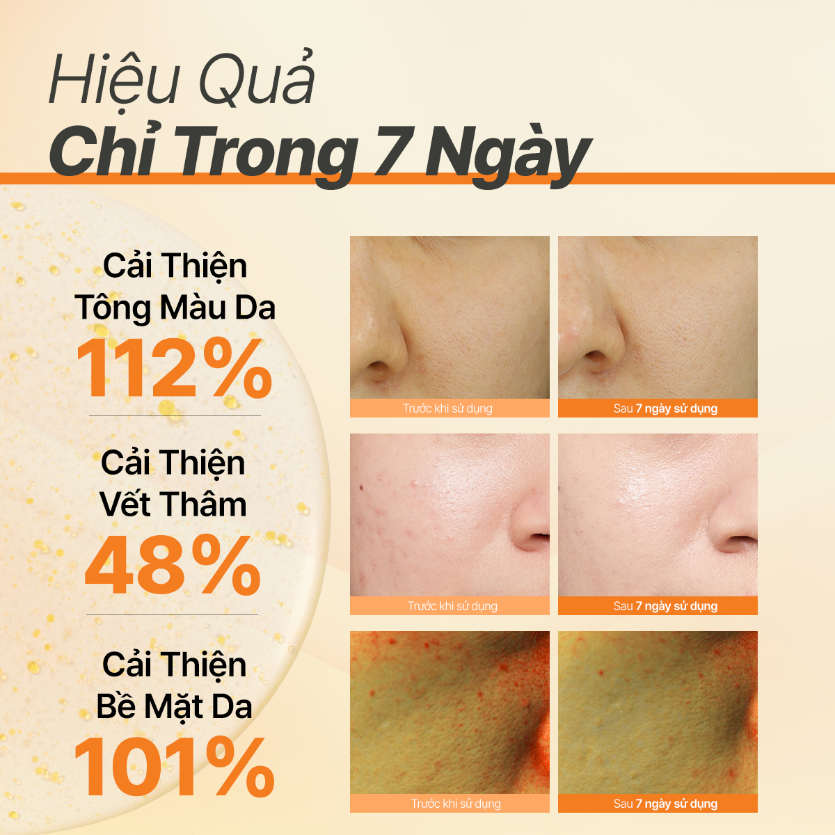 Serum viên nang Vitamin C siêu sáng da INNISFREE Vitamin C Green Tea Enzyme Brightening Serum 30ml