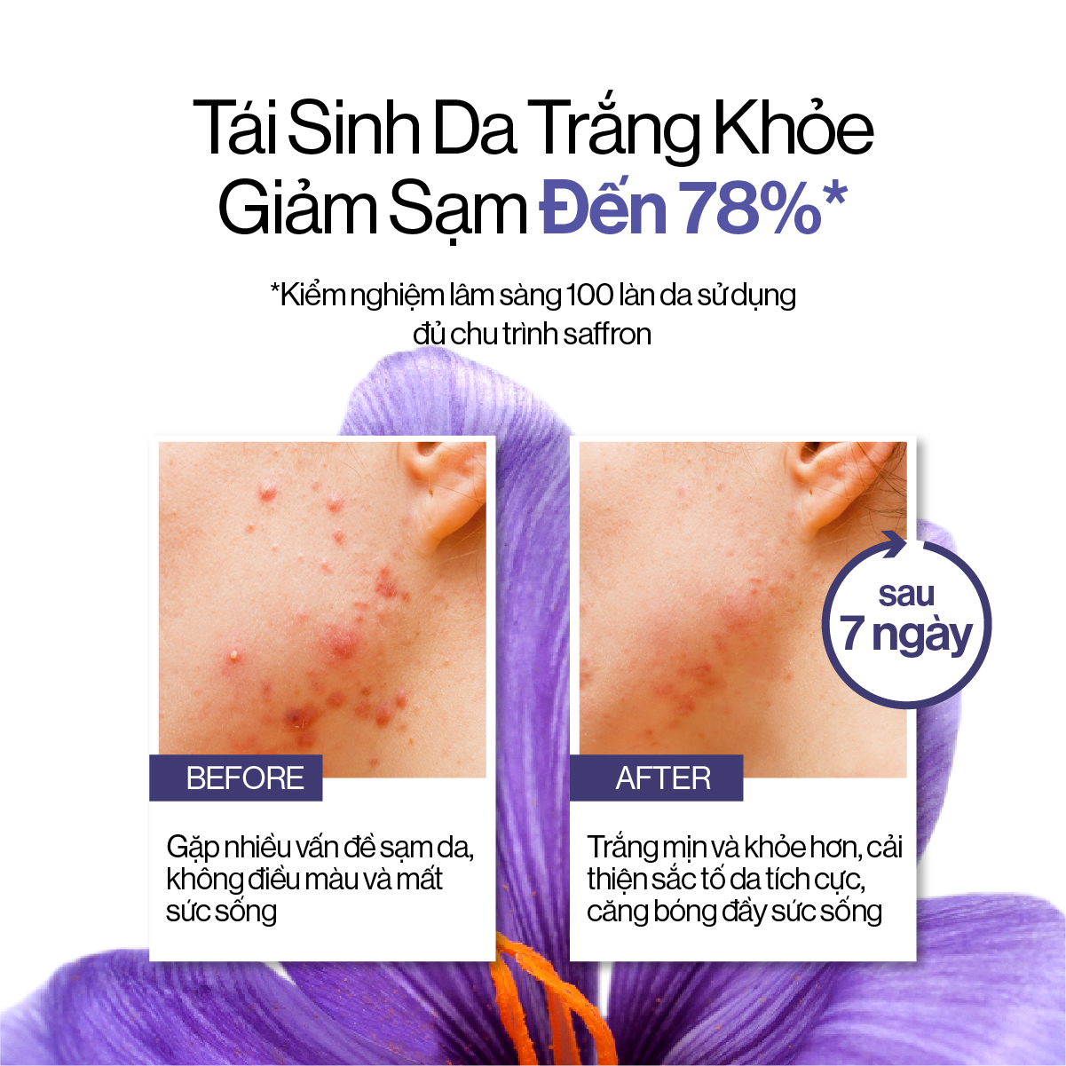 Tinh Chất Đậm Đặc Saffron Trắng Khỏe Mờ Sạm 30ml