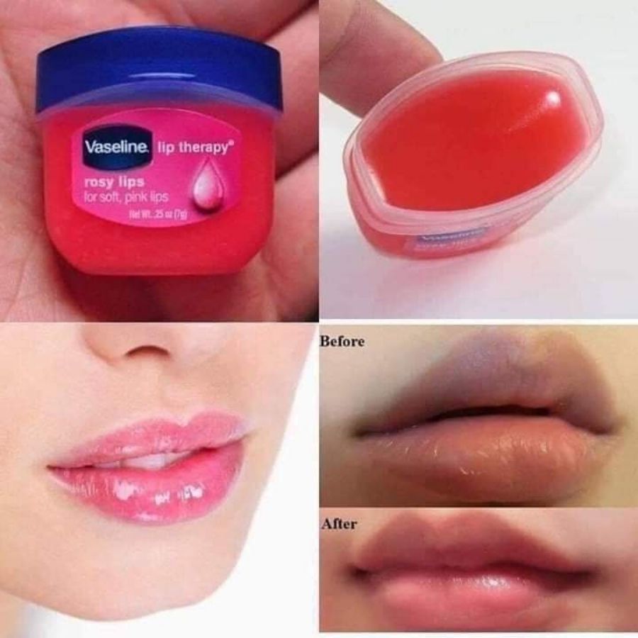 Son Dưỡng VASELINE Lip Therapy Dưỡng Môi Mềm Mịn