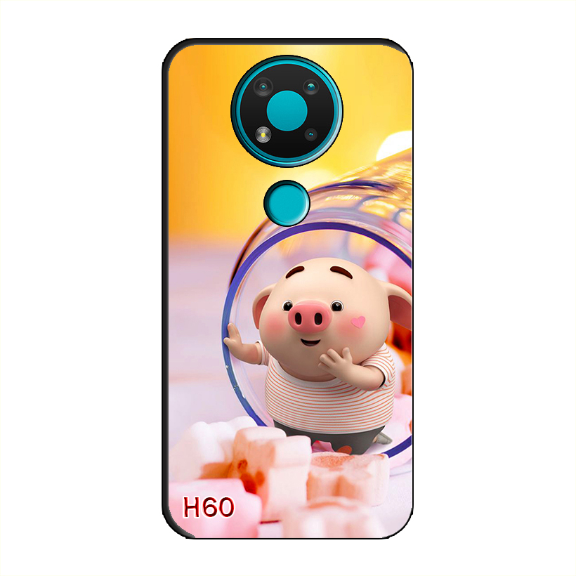 Ốp Dẻo Dành Cho NOKIA 3.4