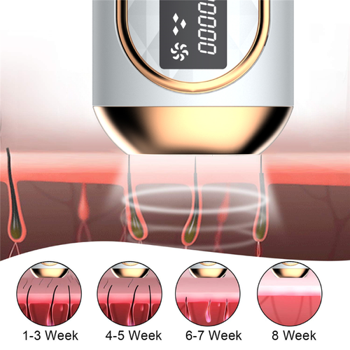 Máy triệt lông tại nhà công nghệ IPL, bóng đèn thạch Anh 100%, công nghệ Mỹ LUX HAIR