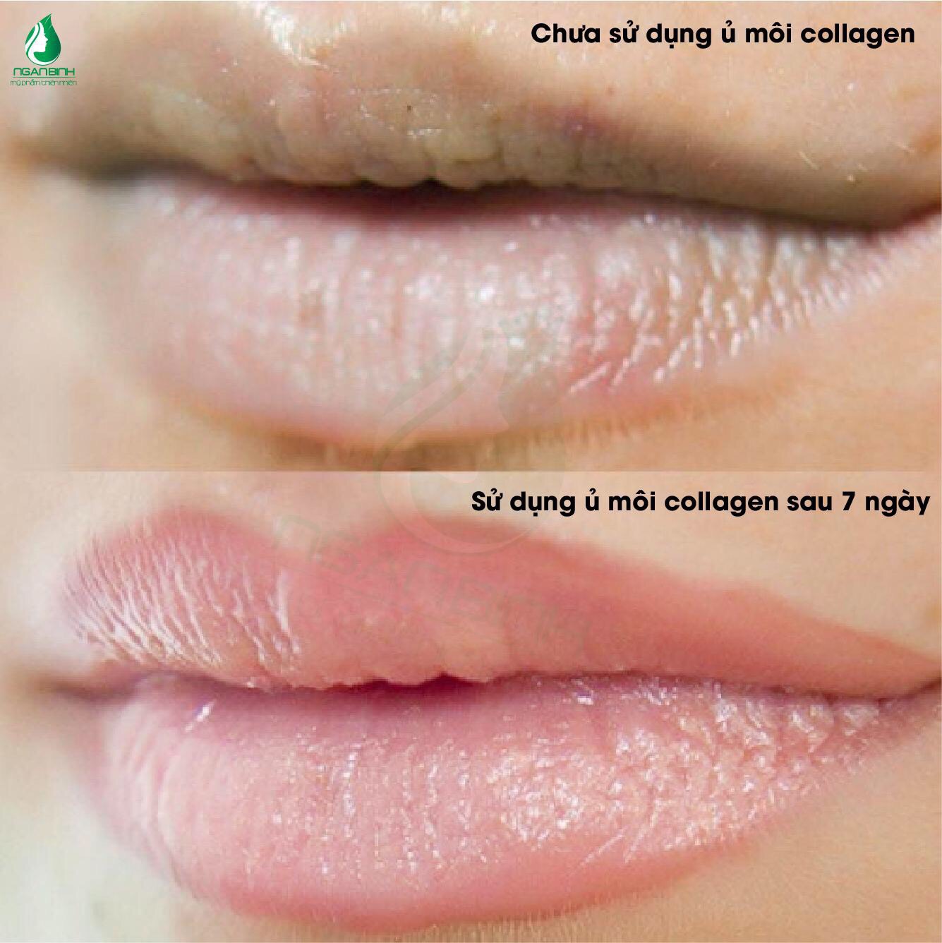 Ủ MÔI COLLAGEN