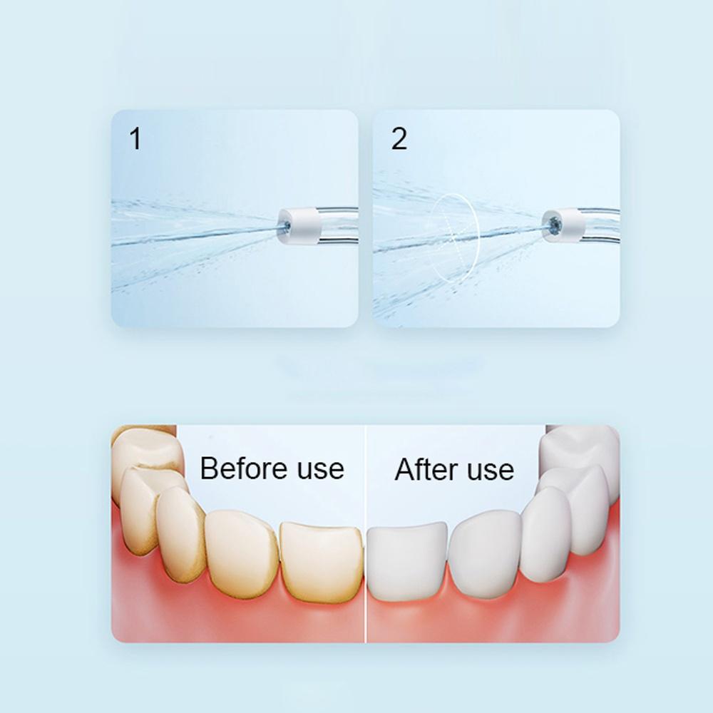 Máy Phun Nước Làm Sạch Răng Miệng Xiaomi MIJIA F300 Kích Thước Nhỏ Gọn