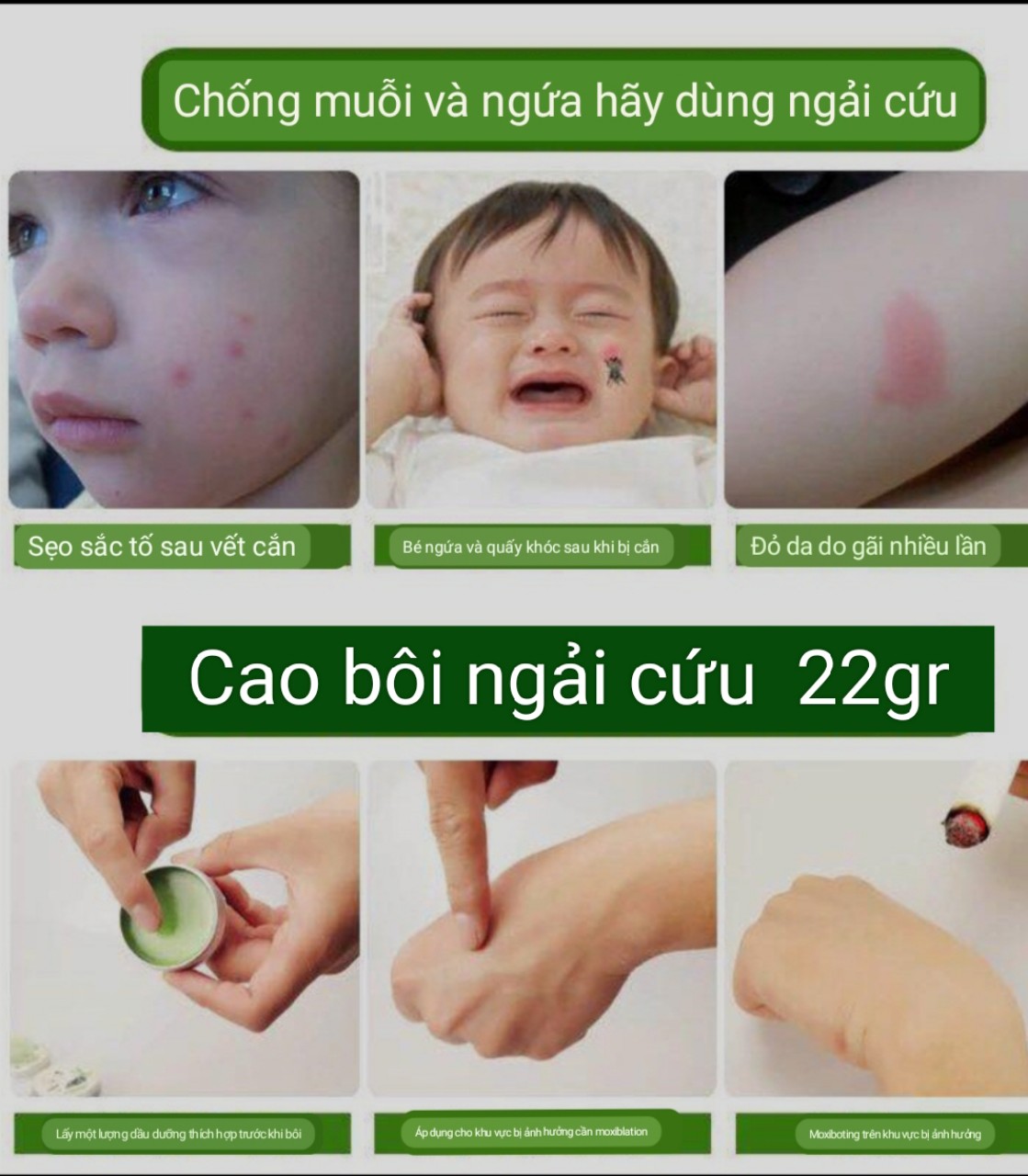 Ngải cứu hoạt lạc cao- cao lá ngải- xoa bóp, mát xa giảm đau, giảm ngứa do côn trùng đốt