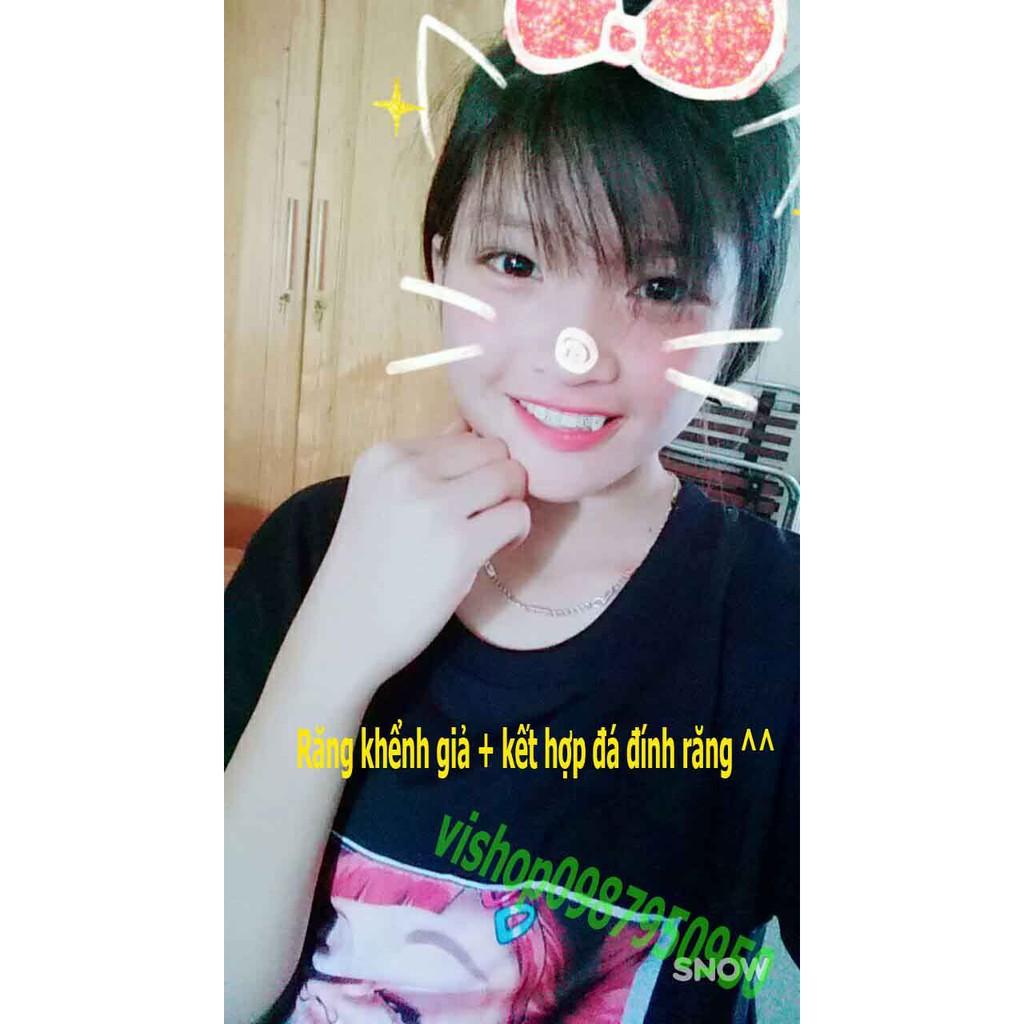 ĐÁ GẮN RĂNG-r87