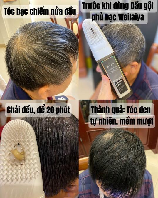 Dầu gội phủ bạc dưỡng tóc weilaiya giúp phục hồi đa tầng