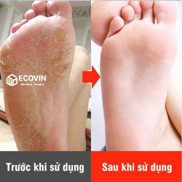 Máy Chà Gót Chân, Làm Sạch Lòng Bàn Chân