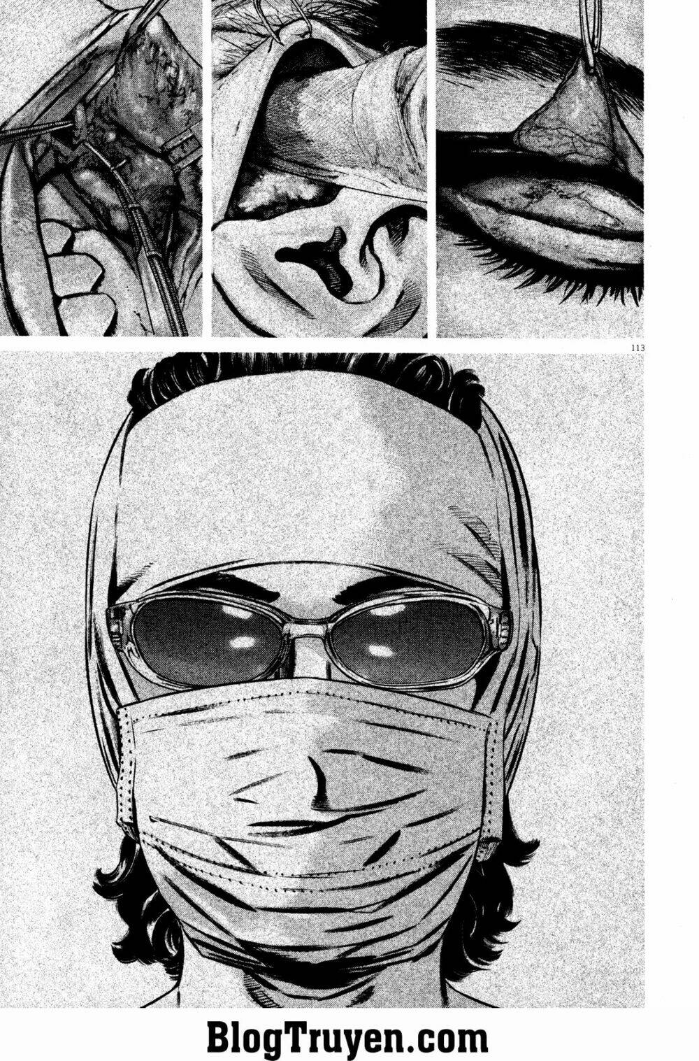 homunculus chapter 76 9