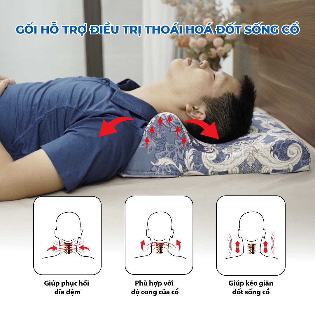 Gối chống thoái hóa cột sống cổ- AIRU giúp giảm đau mỏi cổ vai gáy, giúp máu lưu thông tốt lên não, giúp ngủ ngon và sâu hơn