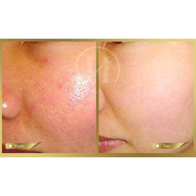 Kem thu nhỏ lỗ chân lông SQS Deep Concentrate