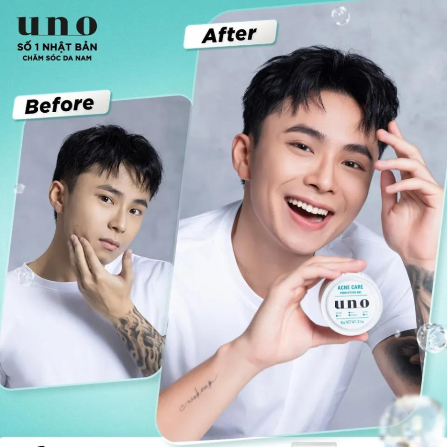 UNO GEL DƯỠNG HOÀN HẢO DÀNH CHO DA MỤN 90G