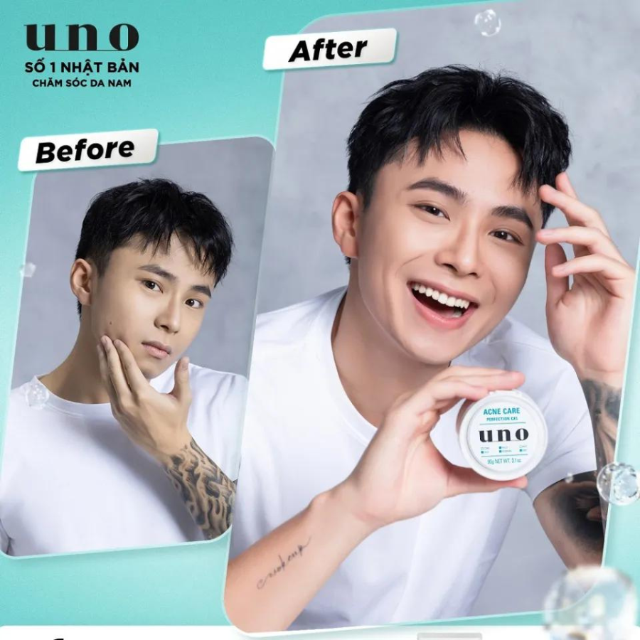 UNO GEL DƯỠNG HOÀN HẢO DÀNH CHO DA MỤN 90G (UNO ACNE CARE PERFECTION GEL 90G)