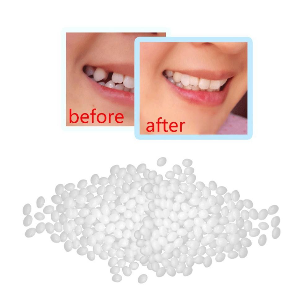 Keo làm răng sứ trong thời điểm tạm thời tiện nghi 10g keo dán giấy khoảng không răng thưa