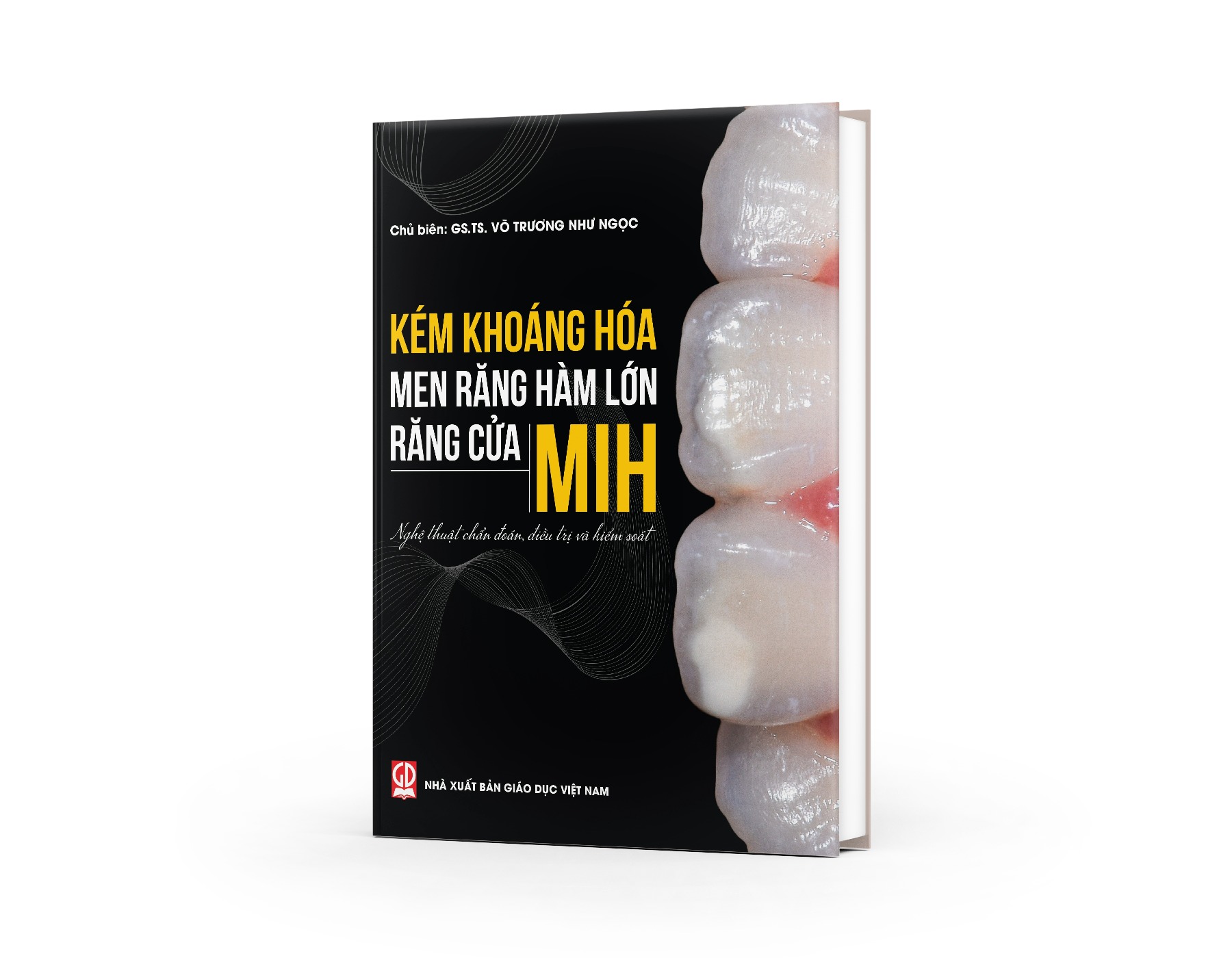 Kém khoáng hóa men răng hàm lớn – răng cửa (MIH) : Nghệ thuật chẩn đoán, ĐT  và kiểm soát