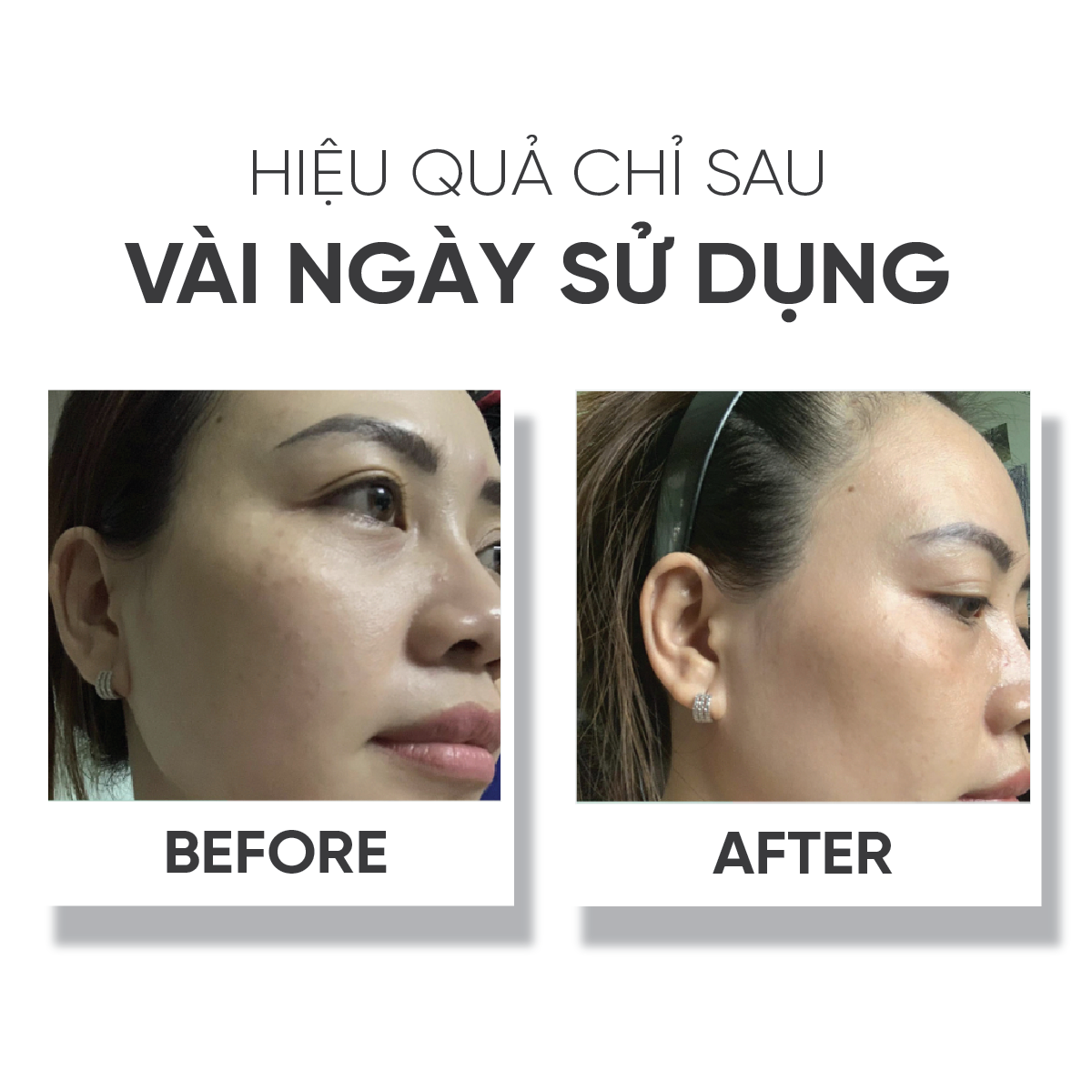Kem dưỡng đêm,dưỡng ẩm,dưỡng trắng da LÁ HOUSE Astalock Night Cream 10ml/30ml