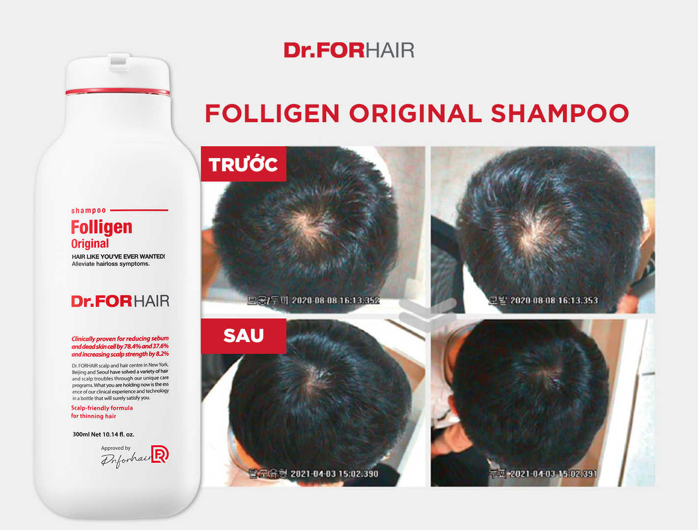 Dầu gội đầu giảm gàu hỗ trợ mọc tóc ngăn rụng giúp phồng tóc Dr.FORHAIR Folligen Original Shampoo