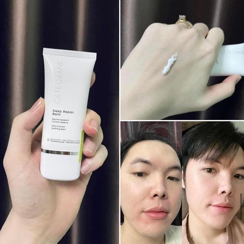 Kem Dưỡng Ẩm Phục Hồi Cho Da Nhạy Cảm Kích Ứng Teoxane Deep Repair Balm 30ml