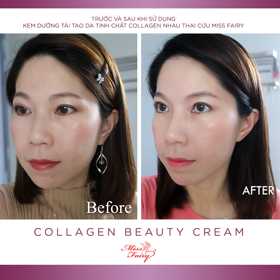 Kem Dưỡng Da Chống Lão Hóa Tinh Chất Collagen Miss Fairy (15g)