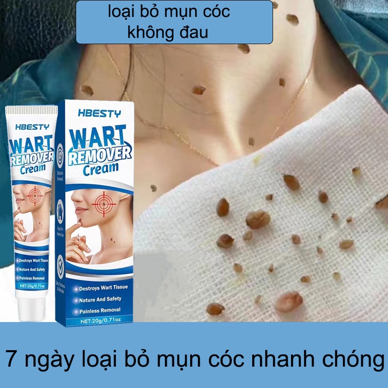 Kem bôi tẩy xóa bỏ mụn cóc mụn thịt nốt ruồi trên da loại tốt hiệu quả cao từ thảo dược thiên nhiên không gây sẹo