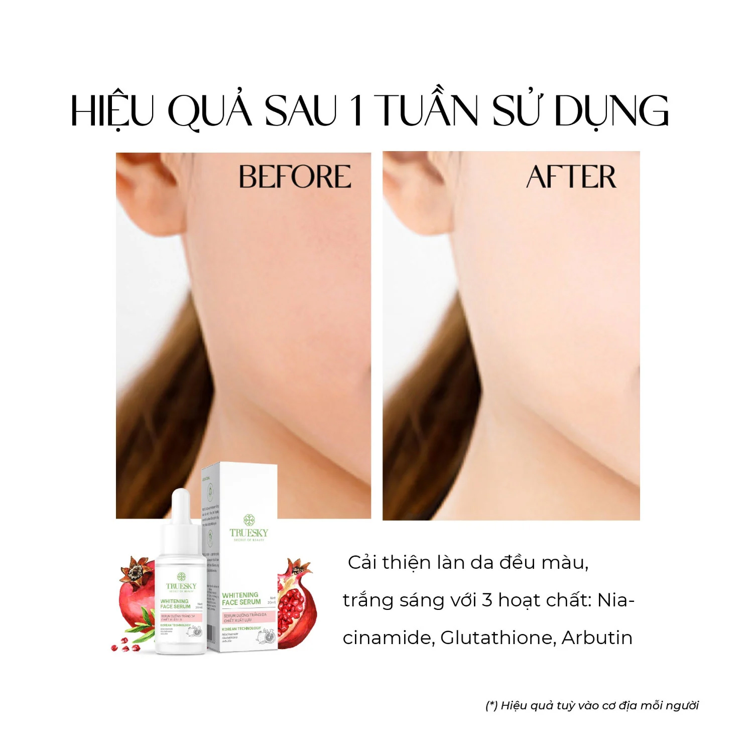 Serum dưỡng trắng da chiết xuất quả lựu Truesky Whitening Face Serum 