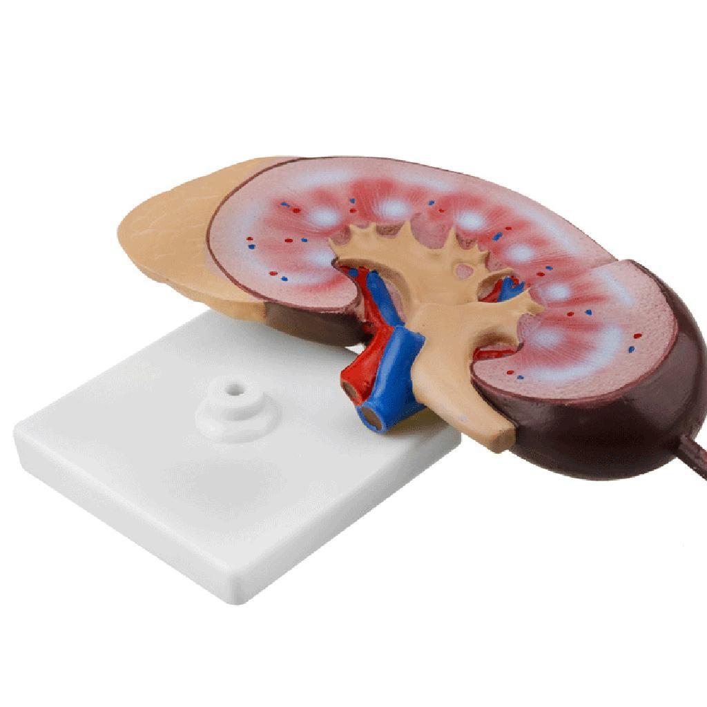 Kidney Anatomical Anatomy Kidney Model Expansion Display Teaching Supplies