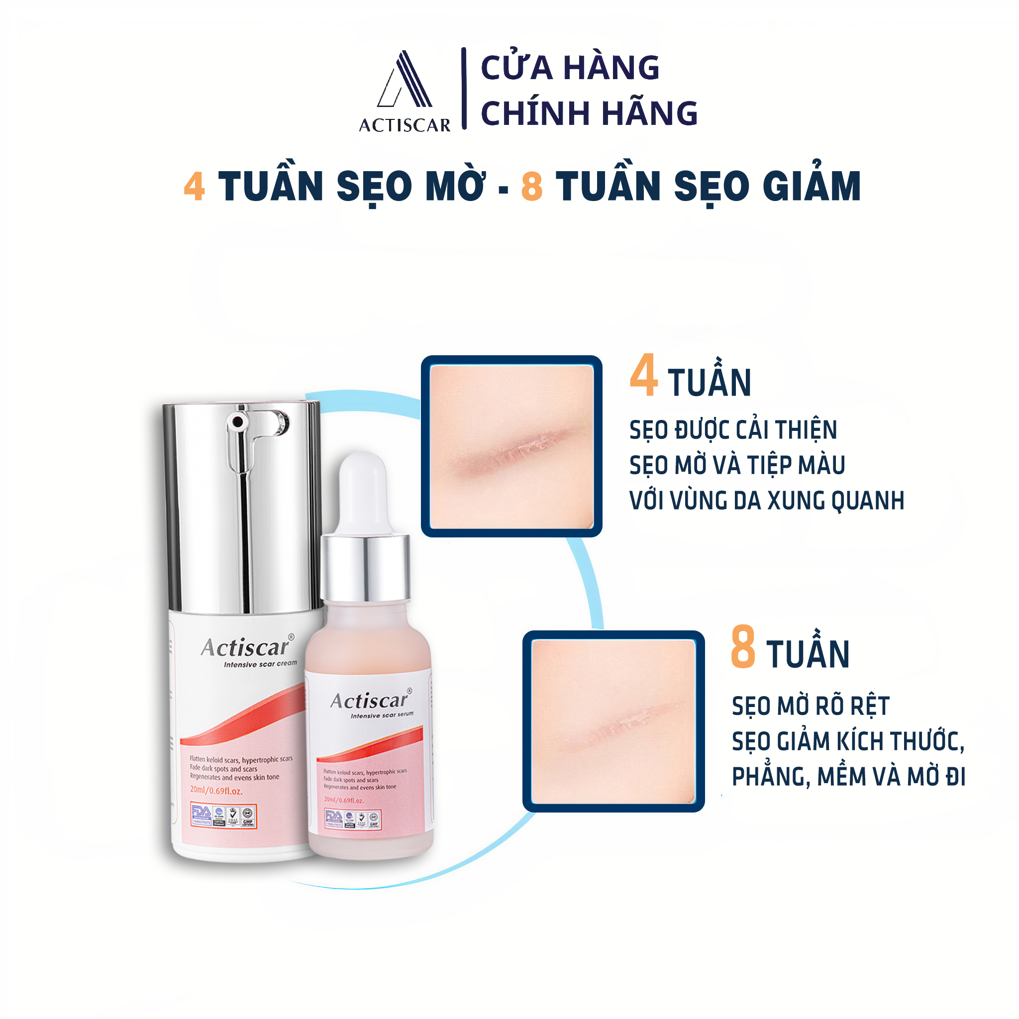 Combo Kem Sẹo và Serum Xóa Sẹo Lồi To, Sẹo Phì Đại Actiscar ( Màu Đỏ)