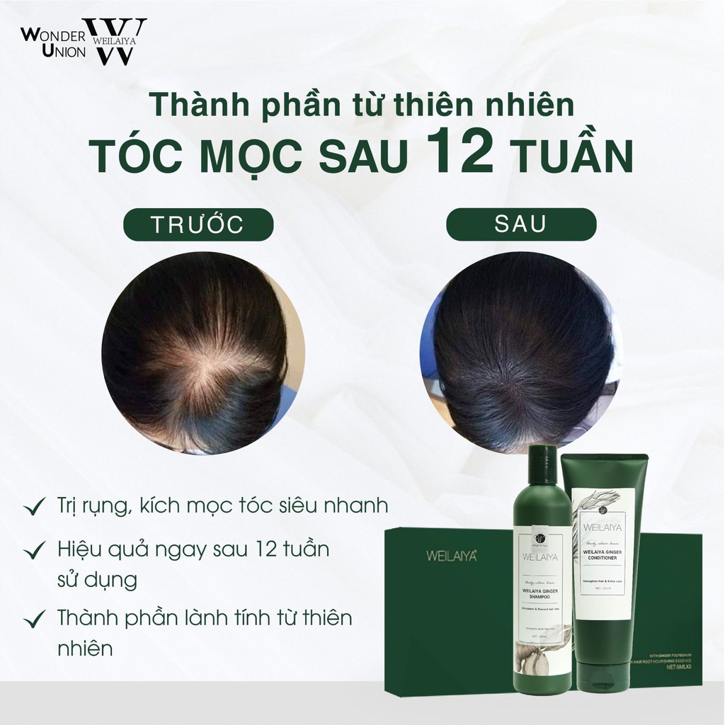 Bộ gội xả weilaiya tinh chất gừng giúp ngăn ngừa rụng và kích mọc tóc 650ml