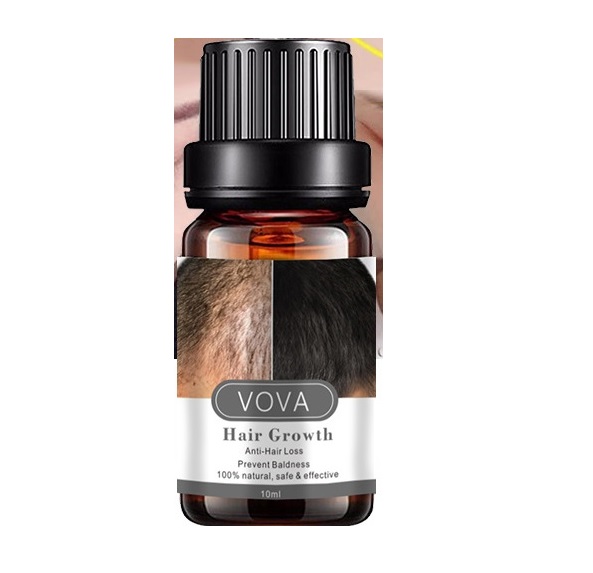 Serum mọc tóc, chống hói, chống rụng, chống gãy tóc, thành phần tự nhiên an toàn và tiện dụng