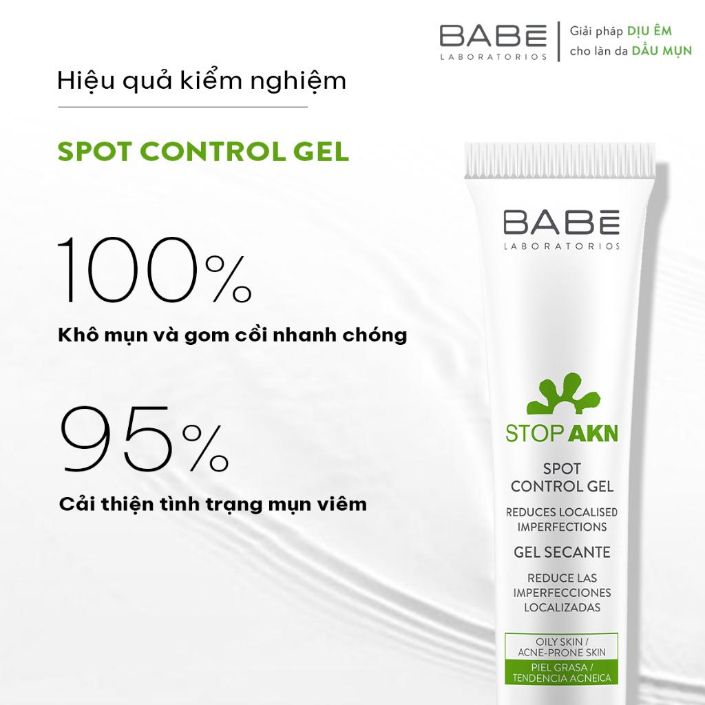 Gel chấm mụn giúp gôm cồi mụn BABÉ Stop Akn Spot Control Gel 8ml