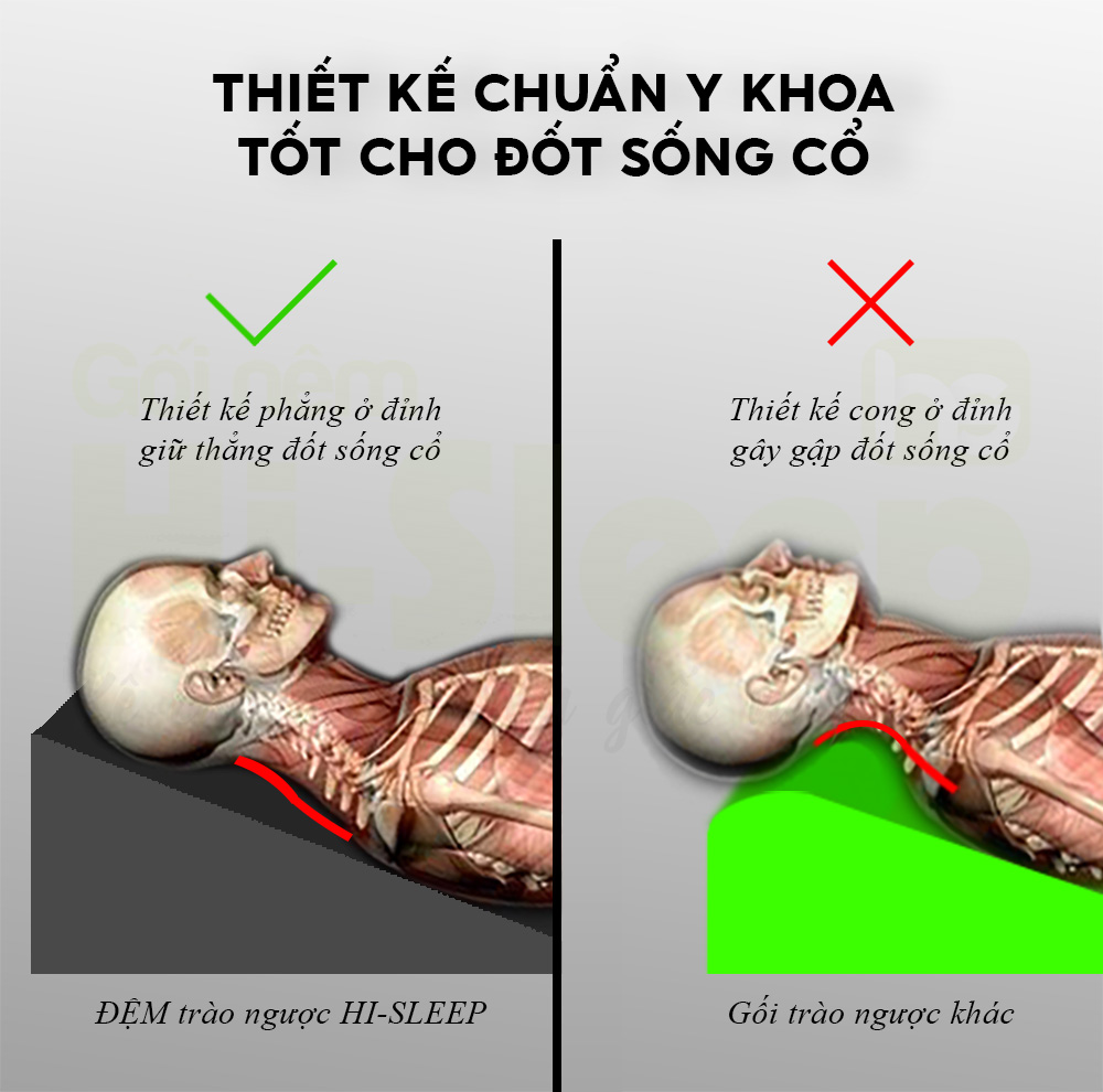 Hình ảnh GỐI CHỐNG TRÀO NGƯỢC DẠ DÀY CHO NGƯỜI LỚN HI-SLEEP - GIẢM VIÊM HỌNG, HO ĐÊM, NGHẸN CỔ, NUỐT VƯỚNG...