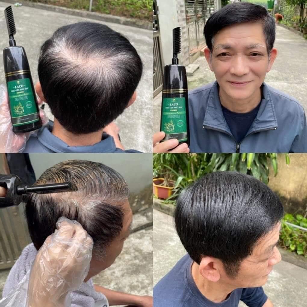 Dầu Gội Phủ Bạc Laco Black Hair - Tóc Đen Tự Tin Sau 9 Phút không phai không sót không hại da đầu mùi thơm chinh hãng sale