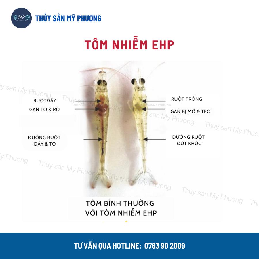 Ks gan tôm thẻ chuyên gan sưng vàng mờ bọng nước đường ruột phân trắng Gometz rớt đáy tấp mé ehp ăn yếu cá lươn ếch