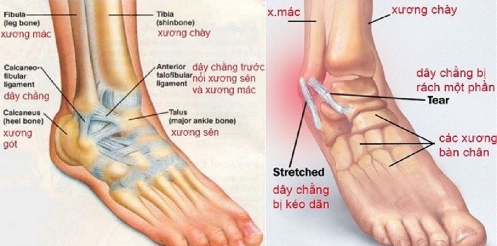 Băng Keo Dán Quấn Cơ Giảm Chống Chấn Thương Loại 5cm & 3cm