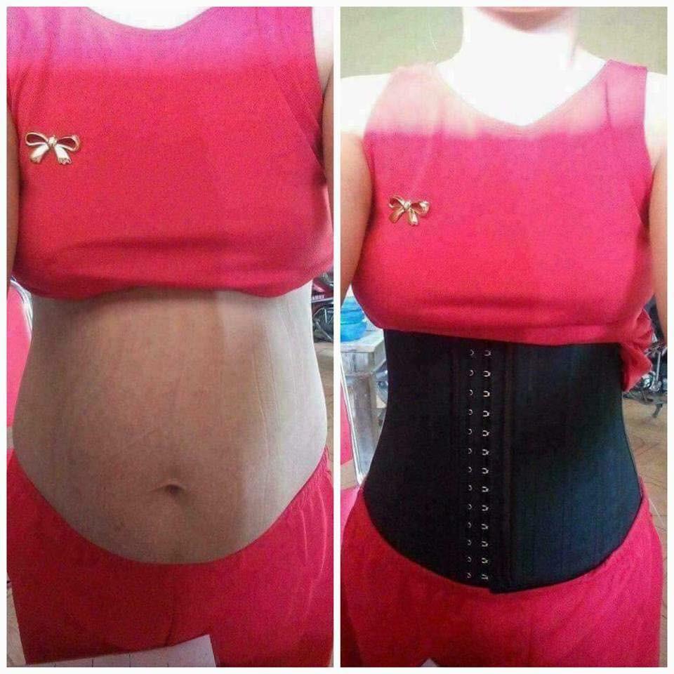 Đai nịt bụng latex Hy Lạp 25 xương - Đai latex thông hơi nhập khẩu - Gen nịt bụng định hình