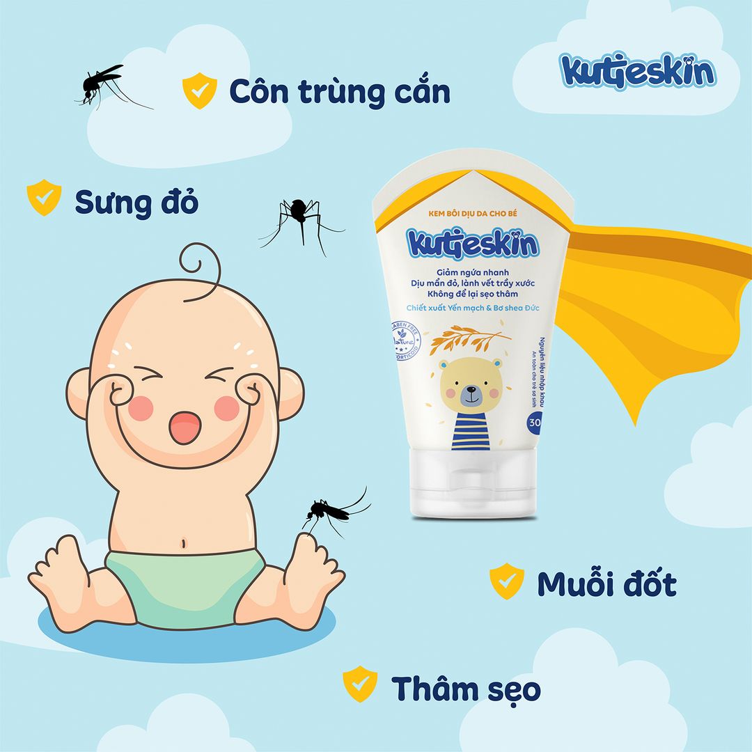 Kutieskin 30gr Kem mẩn ngứa – hăm Kutieskin